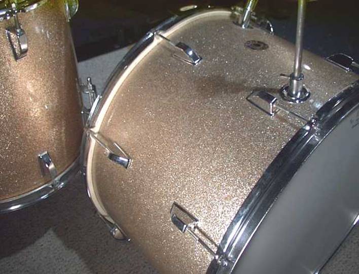 kentchampset5